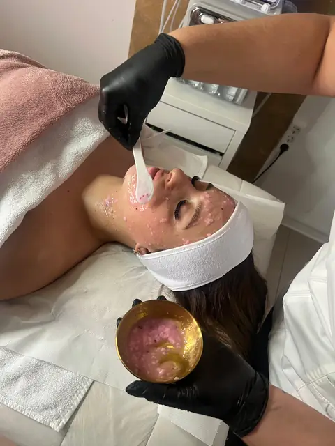 HydraFacial tretman lica